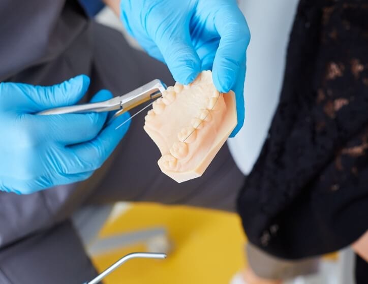 Aparat dentar - Mai mult deact dinti drepti