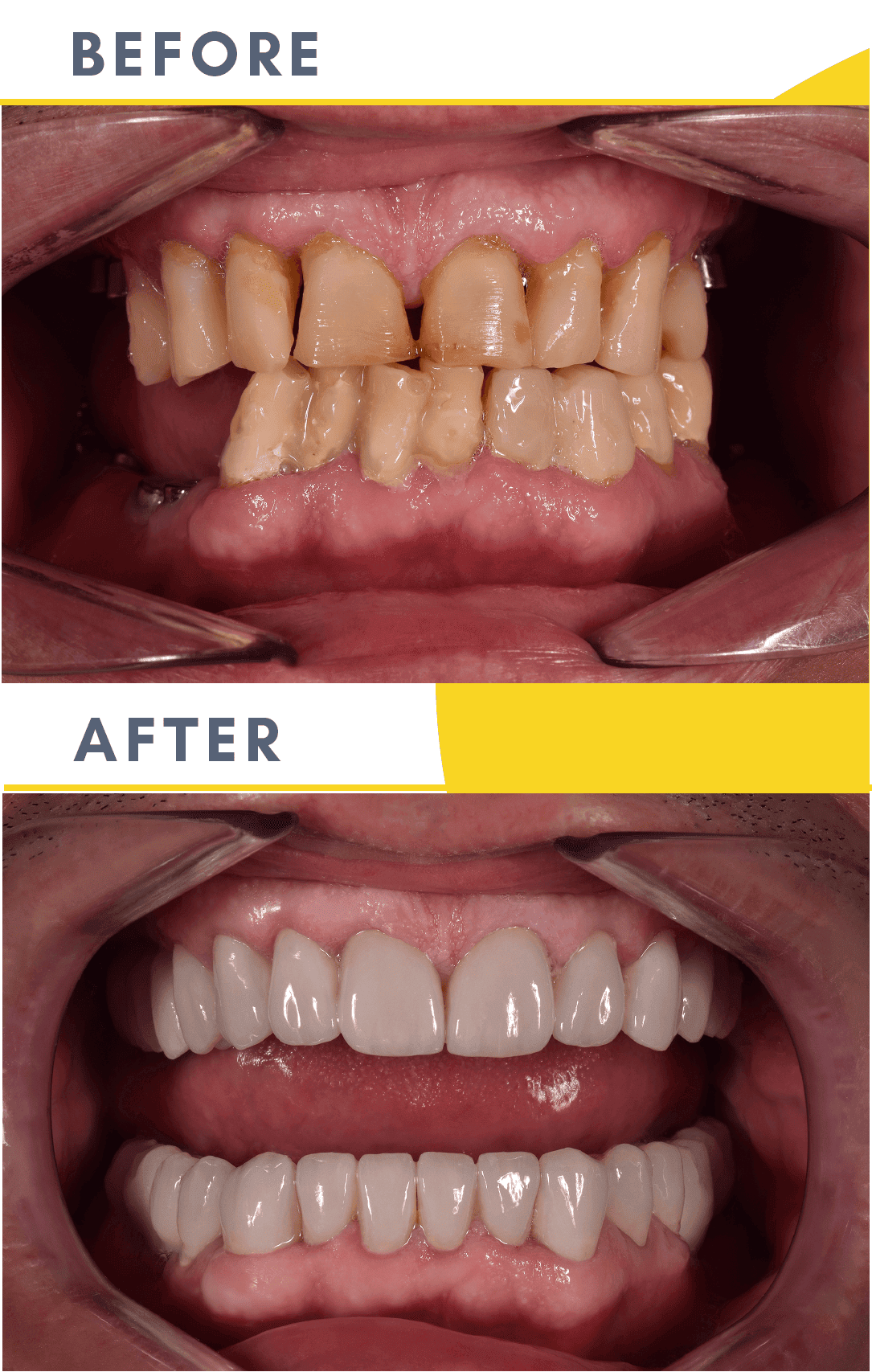 Cazuri Clinica Dentaline